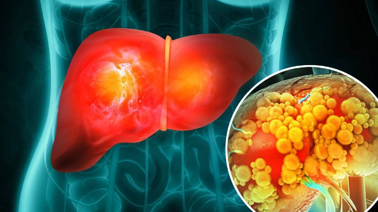 तुमच्या लिव्हरसाठी ‘हे’ 3 प्येय फायदेशीर, जाणून घ्या तुमच्या लिव्हरसाठी ‘हे’ 3 प्येय फायदेशीर, जाणून घ्या