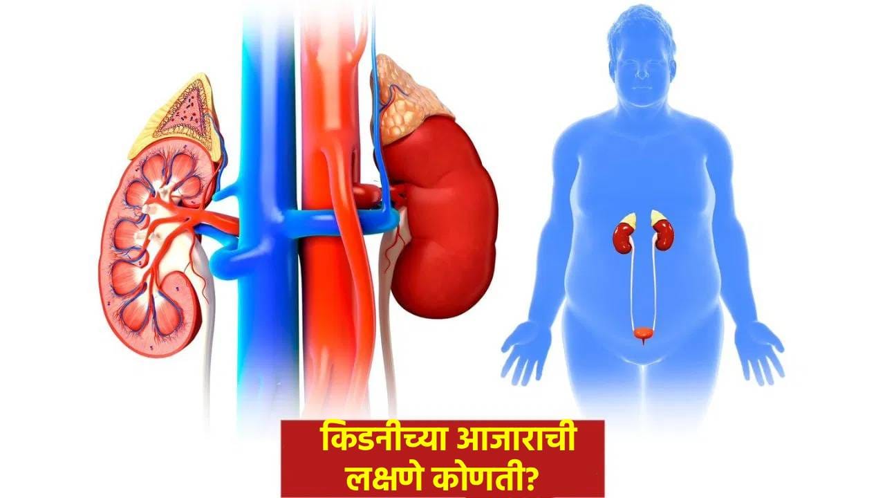 कोणत्या देशांमध्ये किडनीच्या आजाराचे सर्वाधिक रुग्ण? जाणून घ्या