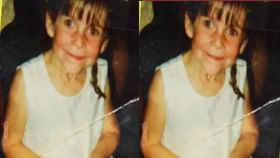 निसर्गाचा अजब खेळ, लहानपणीच चिमुकलीला आलं म्हातारपण, पण कसं?