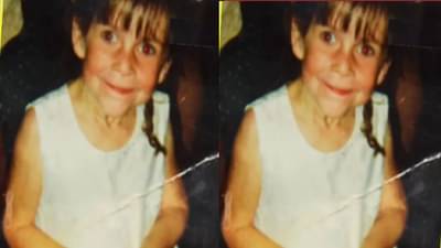 निसर्गाचा अजब खेळ, लहानपणीच चिमुकलीला आलं म्हातारपण, या प्रकरणात असं होणं शक्य