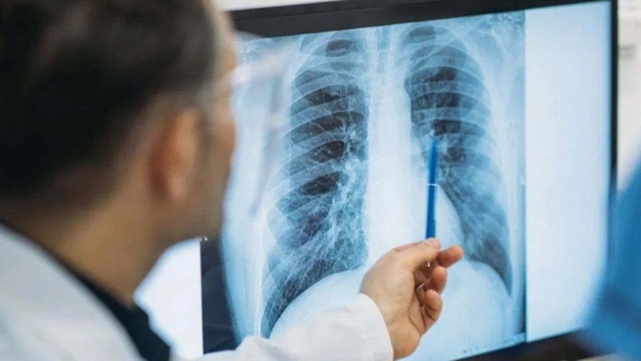 फुफ्फुसाचं आरोग्य राखण्यासाठी आहारात ‘या’ पदार्थांचा करा समावेश