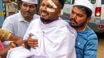 Air India Plane Crash मध्ये 241 दगावले, फक्त एकटा रमेश कुमार वाचला, त्यांचं जिवंत राहणं चमत्कार की शिक्षा? आज कशी आहे त्याची अवस्था?