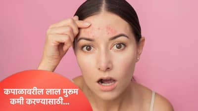 कपाळ लाल मुरुमांनी भरले आहे का? ‘हे’ उपाय जाणून घ्या