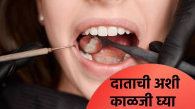 दाताची कीड 100 टक्के नष्ट होईल, ‘या’ गोष्टी जाणून घ्या