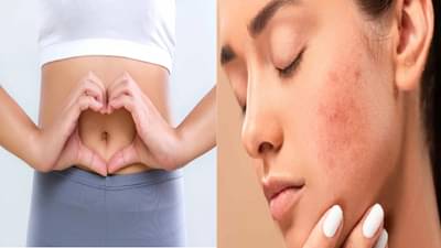 पिंपल येण्याचा आणि पोटाचा काही संबंध असतो का? सत्य काय आहे?
