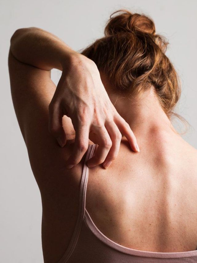 त्वचेवर वारंवार खाज येत असेल कोणत्या आजाराचे लक्षण