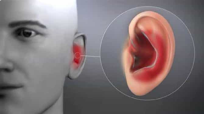 बदलत्या ऋतूमध्ये कानाचं इंफेक्शन होऊ नये म्हणून नेमकं काय करावे?