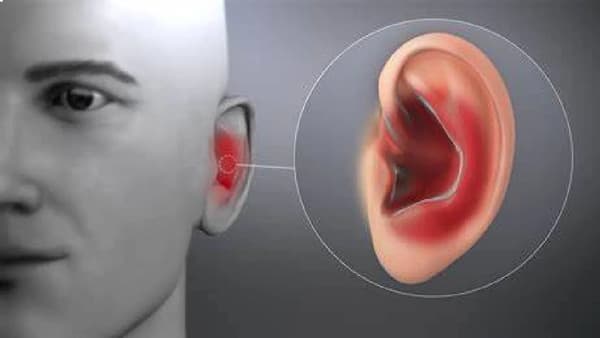 बदलत्या ऋतूमध्ये कानाचं इंफेक्शन होऊ नये म्हणून नेमकं काय करावे?