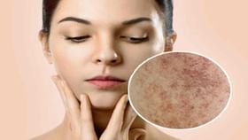 चेहऱ्यावरील काळ डाग होतील छूमंतर.... 'या' तेलाचा करा योग्य पद्धतीनं...