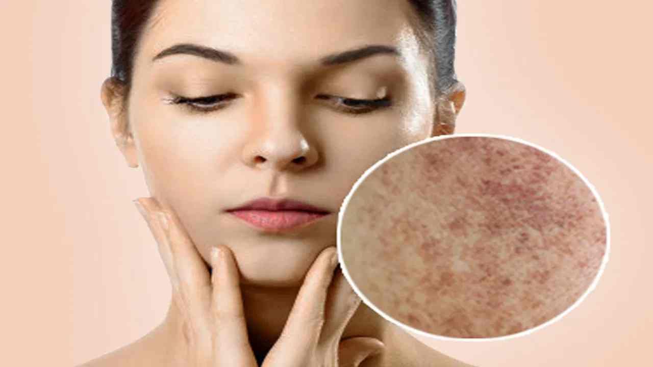 चेहऱ्यावरील काळ डाग होतील छूमंतर.... 'या' तेलाचा करा योग्य पद्धतीनं वापर चेहऱ्यावरील काळ डाग होतील छूमंतर.... 'या' तेलाचा करा योग्य पद्धतीनं वापर