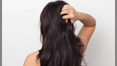 थंडीमध्ये कोंड्याच्या समस्या वाढल्यात? तज्ञांनी सांगितले हे काही घरगुती हेअर मास्क