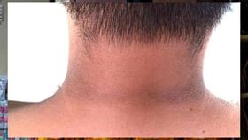 मानेवरील काळपटपणा होईल दूर...'हा' घरगुती उपाय नक्की ट्राय करा