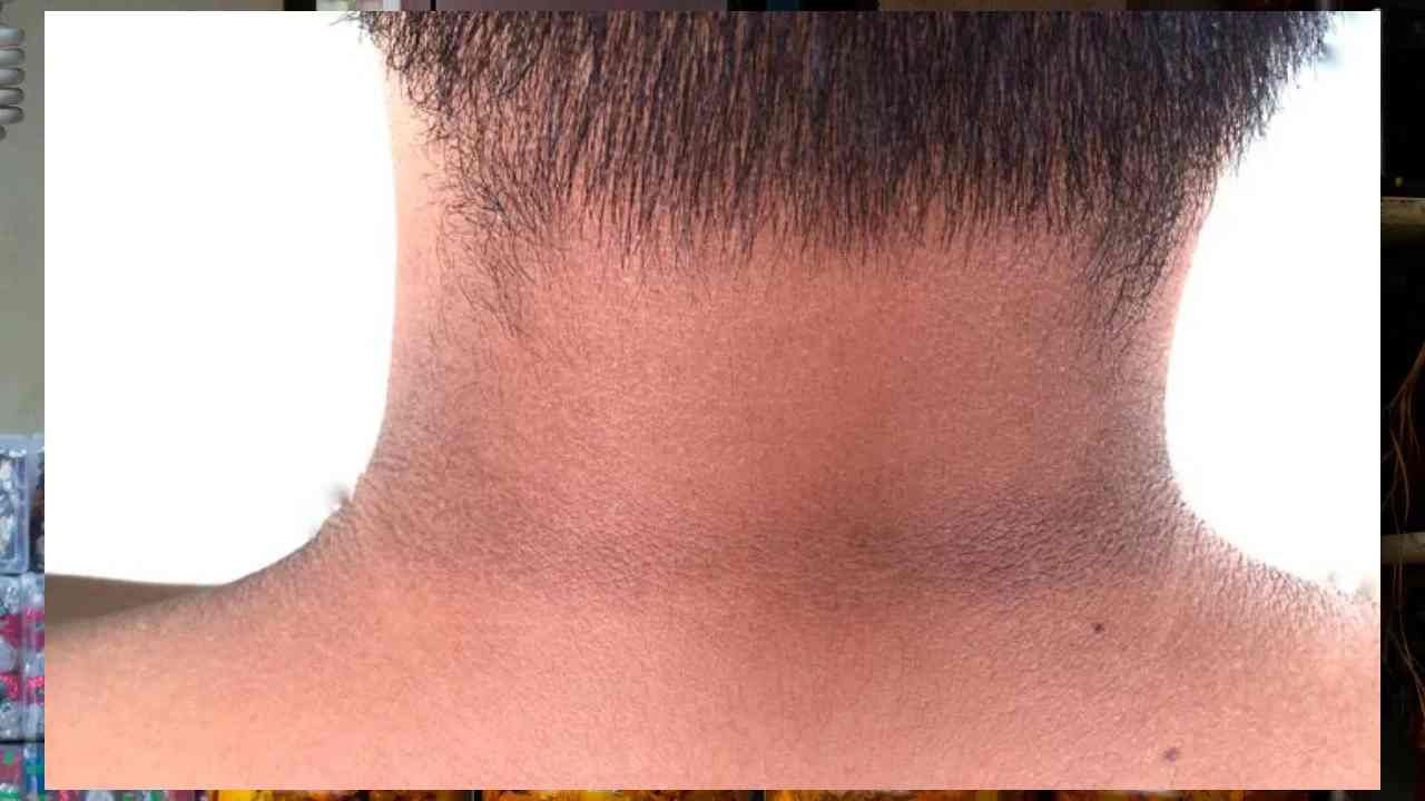 मानेवरील काळपटपणा होईल दूर...'हा' घरगुती उपाय नक्की ट्राय करा