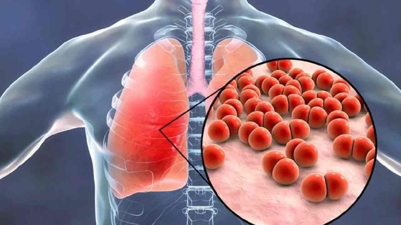 न्यूमोनिया झाल्यास कशी काळजी घ्यावी? जाणून घ्या...