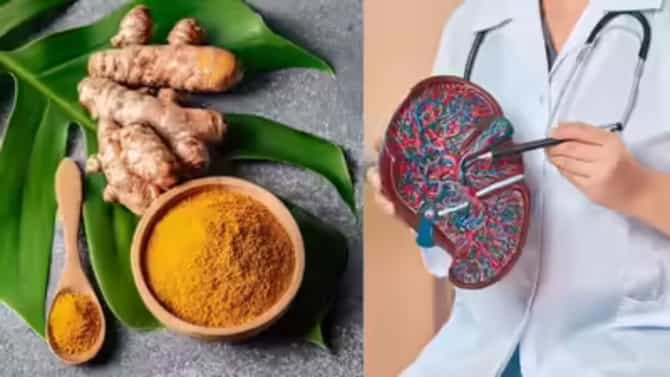 हळद जास्त पोटात गेली तर किडनी आणि लिव्हर फेल ? सुरक्षित प्रमाण काय ?