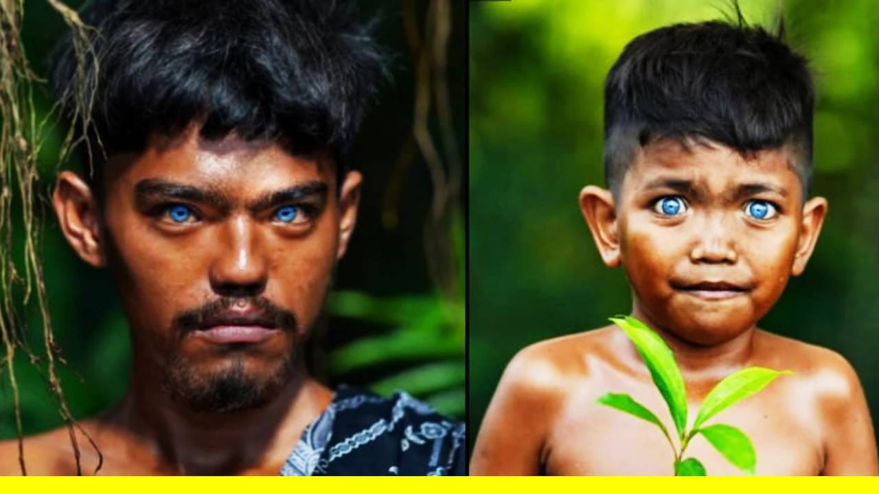 या निळ्या रंगांमुळे ते अत्यंत आकर्षक दिसतात. मुली तरुणी आणि महिलांचेच नाही तर पुरुषाचे सौंदर्य खुलते. या निळ्या डोळ्यांनी तेव्हा ते एखाद्याकडे एकटक पाहतात. तेव्हा काळजी चोरल्याचा भास होतो. पण हे चमकते निळे डोळे (Shining Blue Eyes) या लोकांसाठी अभिशाप आहे. कारण एक दुर्लभ आजार  वॉर्डनबर्ग सिंड्रोममुळे (Waardenburg Syndrome) त्यांचे डोळे असे निळेशार झाले आहेत. 