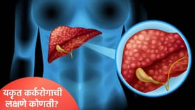 लिव्हर कॅन्सरची लक्षणे कोणती आहेत? उपायांसह जाणून घ्या.