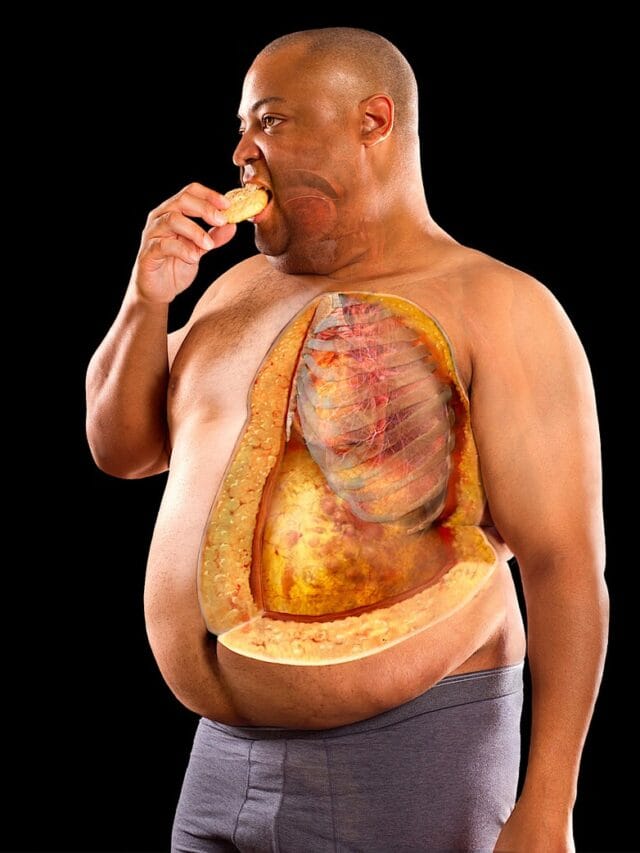 लठ्ठपणामुळे होणारे 10 गंभीर आजार कोणते ?