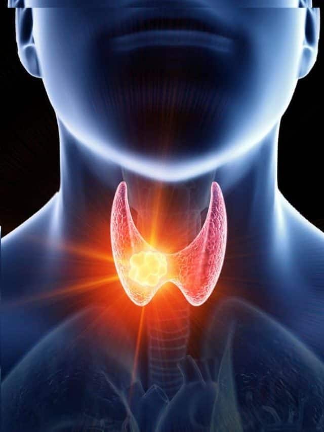 थायरॉईडची लक्षणे आणि घरगुती उपाय काय ?