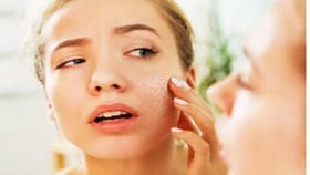 हिवाळ्यात Dry Skin मुळे त्रस्त? आता No Tention, करा हा घरगुती उपाय.