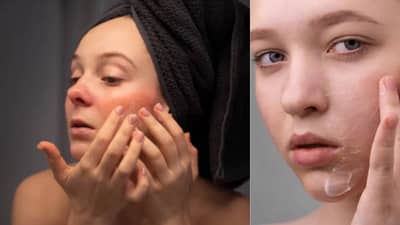 तुमच्या शरीरात या व्हिटॅमिनची कमतरता भासल्यास त्वचा होते कोरडी, यासाठी त्वरित करा हे उपाय