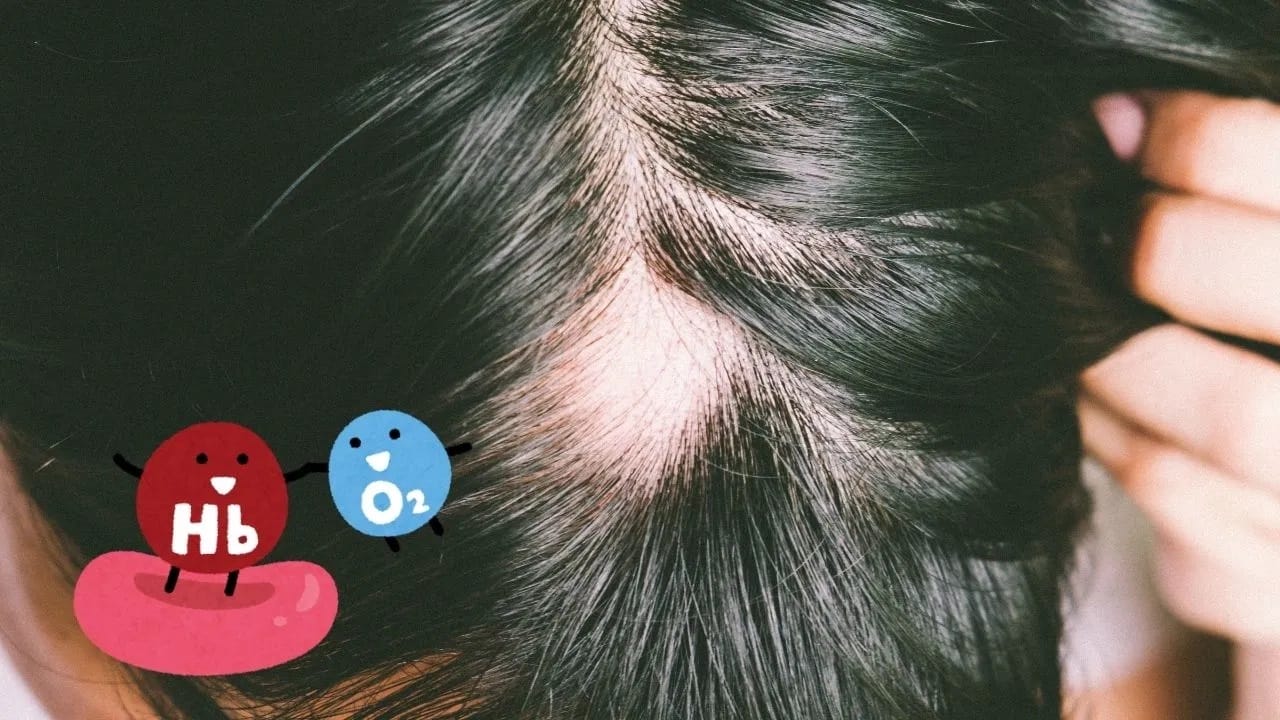 व्हिटॅमिन डी संसर्गाशी लढण्यास मदत करते. त्याच्या कमतरतेमुळे टाळूला खाज सुटू शकते आणि केस गळू शकतात. ही कमतरता दूर करण्यासाठी तुम्ही पूरक आहार घेण्यची नितांत गरज आहे.