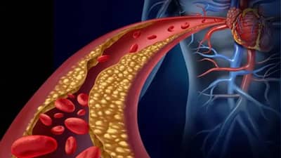हिवाळ्यात कोलेस्ट्रॉल कमी करून हृदयाचे आरोग्य सुधारायचे? आहारात या पदार्थांचा करा समावेश