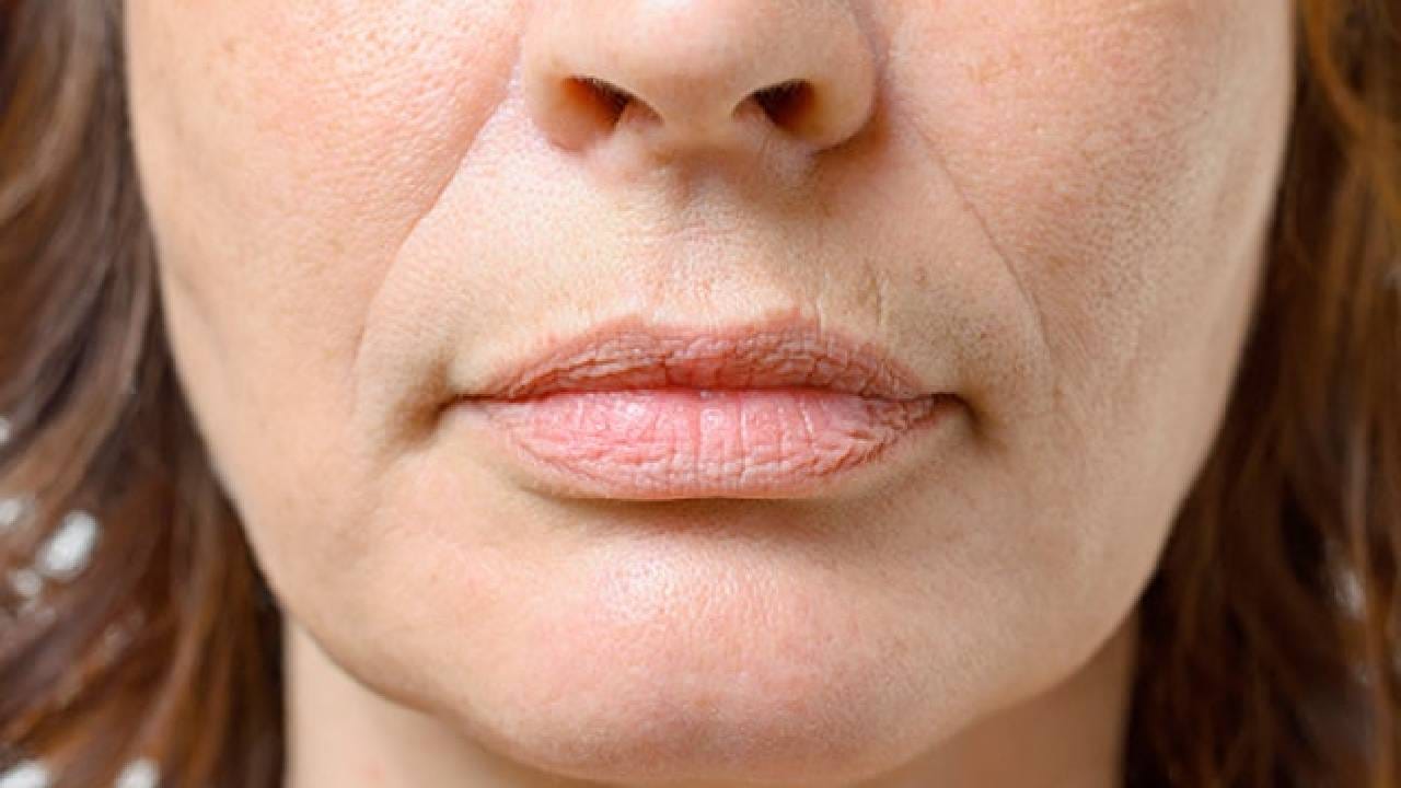 बऱ्याचदा चेहऱ्यावरील सुरकुत्या ही मोठी समस्या बनते. जर तुम्हालाही ही समस्या असेल तर काही गोष्टी फॉलो करा, ज्यामुळे ही समस्या कायमची जाईल. 