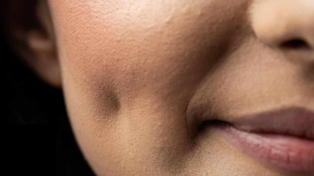 Dimples Interesting Facts: गालाच्या एका बाजूला अथवा दोन्ही बाजूला खळी पडते. ही खळी पडणारी स्त्री सुंदर आणि मनमोहक भासते. पुरुषांच्याही गालाला खळी पडते, तेव्हा तो शोभून दिसतो. चारचौघात अशी व्यक्ती जरा  जास्तीचा भाव खाऊन जाते. चेहरा अधिक आकर्षक दिसत असल्याने एका स्माईलनेच अनेकांचं काळजी घायळ होतं.