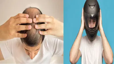 Helmet And Hair Fall Connection: हेल्मेट घातल्याने केस गळतात का? सत्य जाणून घ्या