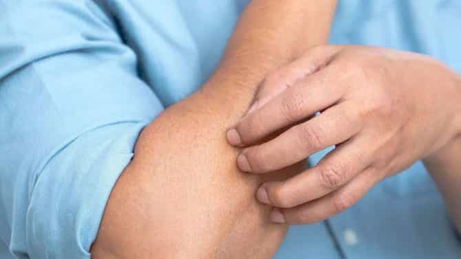 ड्राय स्किनपासून सुटका हवी आहे? घरच्या घरी करा हे बेस्ट उपाय...