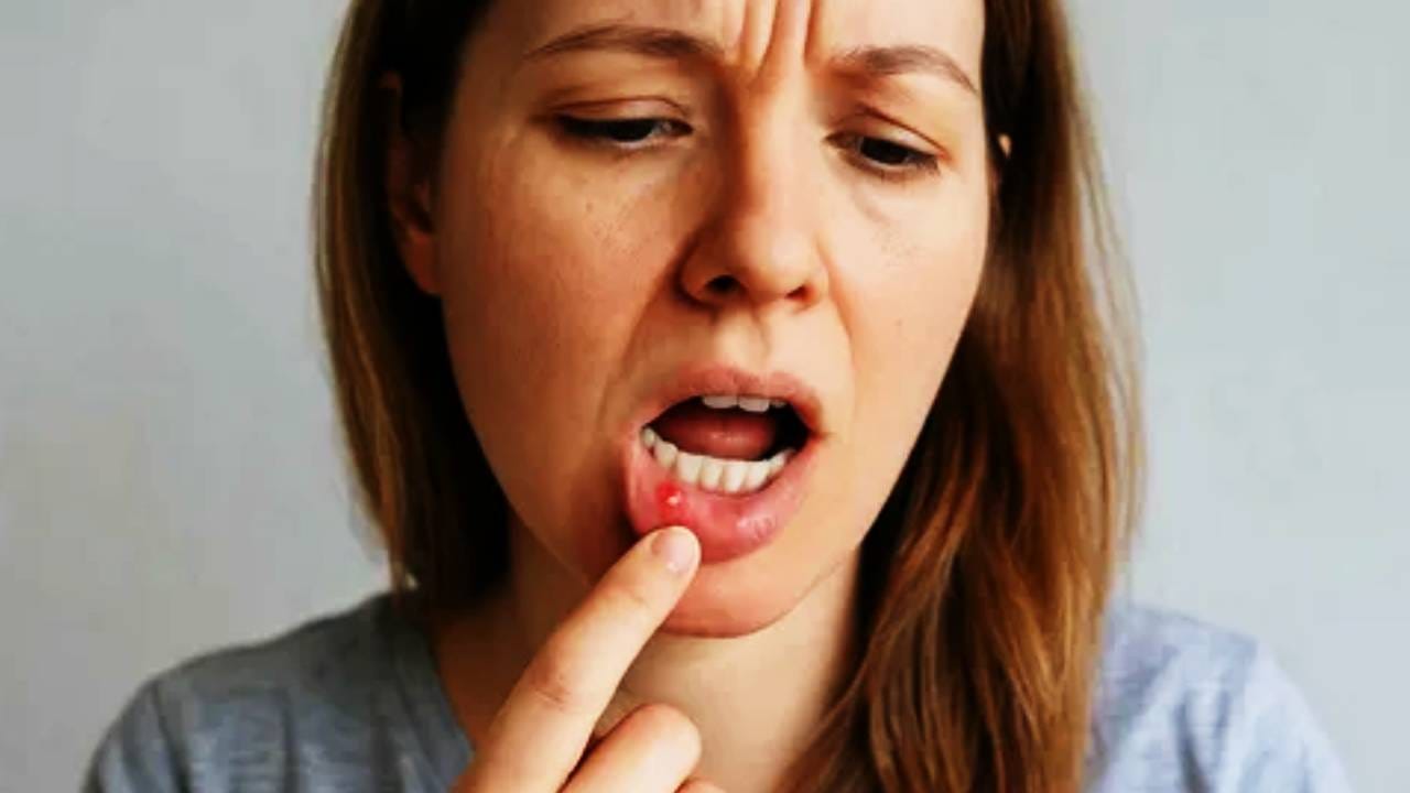 पाणी कमी झाल्याने बद्धकोष्ठतेचा त्रास वाढतो. पाणी कमी झाल्याने पचन क्रिया मंदावते. तर या काळात पचन क्रियेवर ताण येतो. पोट व्यवस्थित साफ होत नाही. त्यामुळे शरीरातील उष्णता वाढते. उष्णतेचा परिणाम होऊन तोंड येते. पोट व्यवस्थित साफ झाले तर तोंड येण्याचे प्रमाण बरेच कमी होते. 