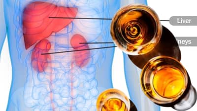 लिव्हर की किडनी ?, दारु कोणत्या अवयवास जास्त खराब करते ?