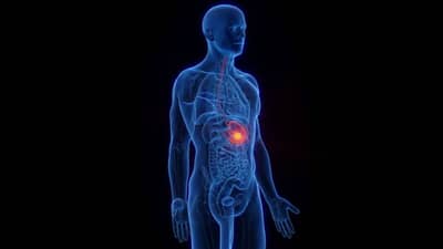 पोटाचा कर्करोग का होतो? पोटाची समस्याही कारण बनते का? जाणून घ्या