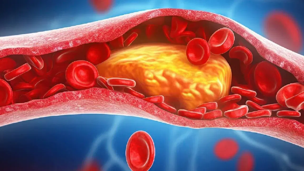 सीडीसीच्या मते, अमेरिकेत सुमारे एक तृतीयांश लोकांच्या रक्तातील कोलेस्ट्रॉलची पातळी जास्त असते. हाय कोलेस्ट्रॉलमुळे हार्ट अटॅक, इतर हृदयरोग आणि स्ट्रोकचा धोका अनेक पटींनी वाढतो. २०१६ मध्ये सॅन डिएगो, कॅलिफोर्नियातील वैज्ञानिकांनी अभ्यास केला. त्यात असे आढळले की, रोज अक्रोड खाल्ल्याने शरीराचे वजन न वाढवता कोलेस्ट्रॉलच्या पातळीवर सकारात्मक परिणाम होतो. संशोधकांनी सरासरी ६९ वर्षे वयाच्या ५१४ ज्येष्ठ व्यक्तींच्या डेटाचा अभ्यास केला. त्यात दिसले की, एक वर्ष सातत्याने रोज अक्रोड खाणाऱ्यांचे LDL कोलेस्ट्रॉल लक्षणीयरीत्या कमी झाले होते.