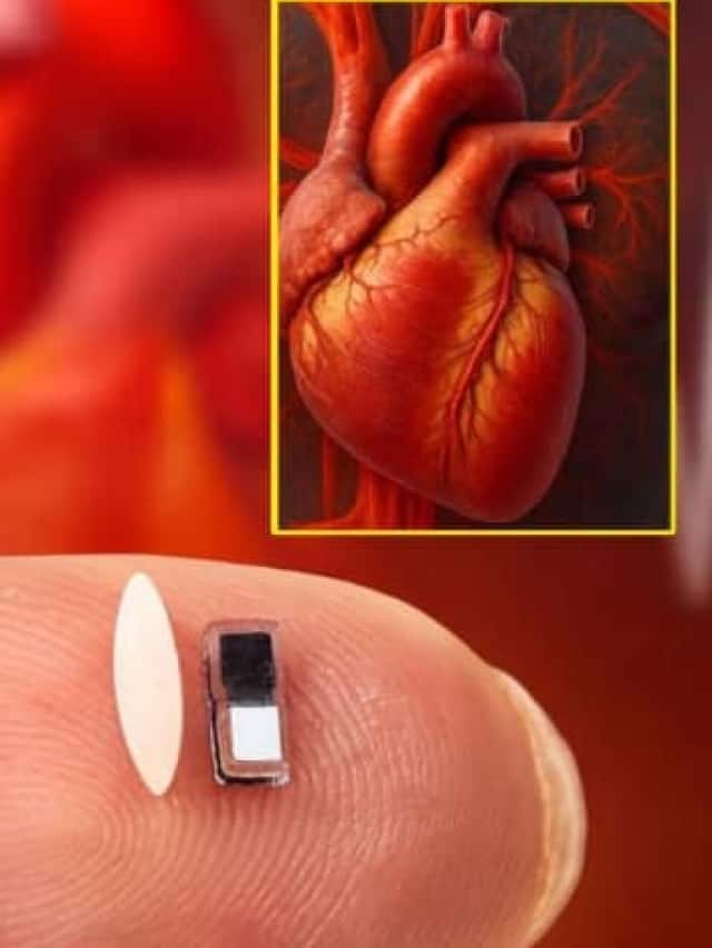 तांदळाच्या आकाराचा डीव्हाईस, करेल हदयाचा आजार बरा