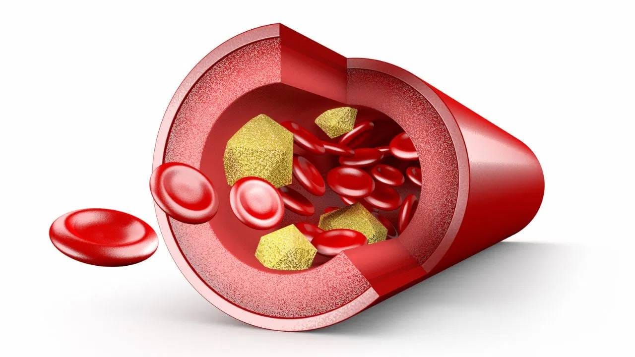 आरोग्यासाठी हळदीचे दूध नक्कीच फायदेशीर आहे. पण सर्वच लोकांसाठी हे फायदेशीर ठरेलच असे सांगणे कठीण आहे. ज्यामुळे ज्यांना हिमोग्लोबिन संबंधित समस्या आहेत, अशांनी हळदीचे दूध पिणे टाळावे. 