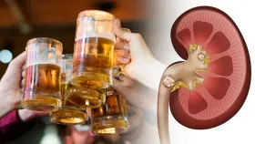 GK : बिअर पिल्यामुळे मूत्रपिंडातील खडे बाहेर पडतात का?.