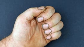 घाणेरडे नखे करत... ग्रहांच्या कोपामुळे आजार वाढतील आणि....