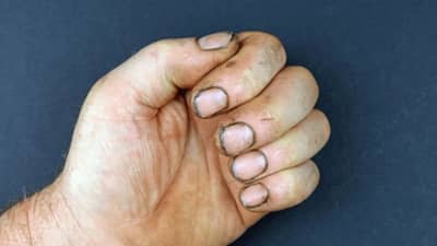 घाणेरडे नखे करत... ग्रहांच्या कोपामुळे आजार वाढतील आणि...