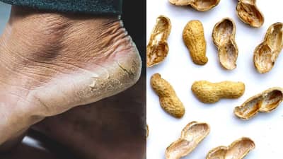 शेंगदाण्याची साल फेकू नका; या पद्धतीनं वापर केल्यास शरीरासाठी ठरेल उपयोगी