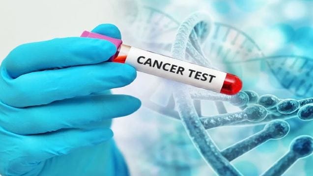 भारतात प्रोस्टेट कॅन्सर पुरुषांना होणारा तिसऱ्या क्रमांकाचा कर्करोग आहे. पहिल्या क्रमांकवर फुप्फुसाचा तर दुसऱ्या क्रमांकावर मुखाचा कर्करोग आहे. जगभरात प्रत्येक वर्षी साधारण 15 लाख लोकांना प्रोस्टेट कॅन्सर होतो.  वय वाढल्यानंतर हा आजार होण्याची शक्यता वाढते. 