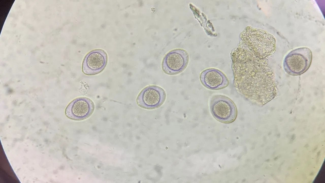 पुरुषांच्या पुनरुत्पादकतेसाठी शुक्राणूंची गुणवत्ता खूप महत्वाची असते. चांगली गुणवत्ता म्हणजे त्यांची पुरेशी संख्या, योग्य आकार आणि चांगली गतिशीलता आवश्यक असते, ज्यामुळे गर्भधारणेची शक्यता वाढत असते.