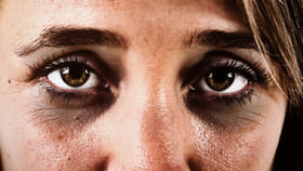 आता चेहऱ्याची सुंदरता खुलणार.. डार्क सर्कल्स कमी करण्यासाठी काय करावे?.