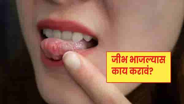 Tongue Burn Remedies : गरमा-गरम चहामुळे भाजली जीभ ? या सोप्या टिप्समुळे मिळेल आराम