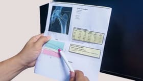 मुलांमध्ये हाडे दुखणे आणि कॅल्शियमच्या समस्या कशामुळे होतात?.