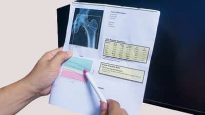 मुलांमध्ये हाडे दुखणे आणि कॅल्शियमच्या समस्या कशामुळे होतात?