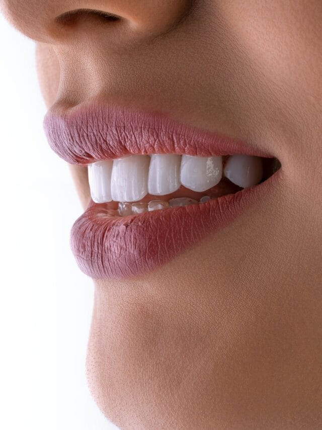 दातांचा पिवळेपणा घरच्या घरी असा दूर करा, मोत्यांसारखे चमकतील दात