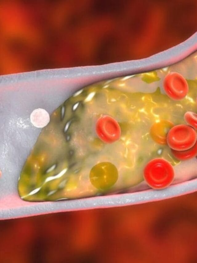 कोलेस्ट्रॉल कंट्रोल करण्यासाठी काय खावे ?