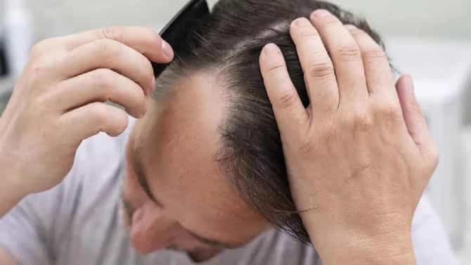 केस गळतीचं खरं कारण तर, तुमच्या स्वयंपाक घरात... तात्काळ करा महत्त्वाचे बदल, होईल फायदा